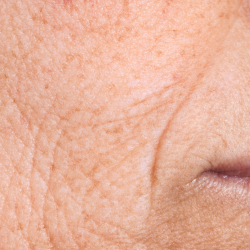 Anti ageing